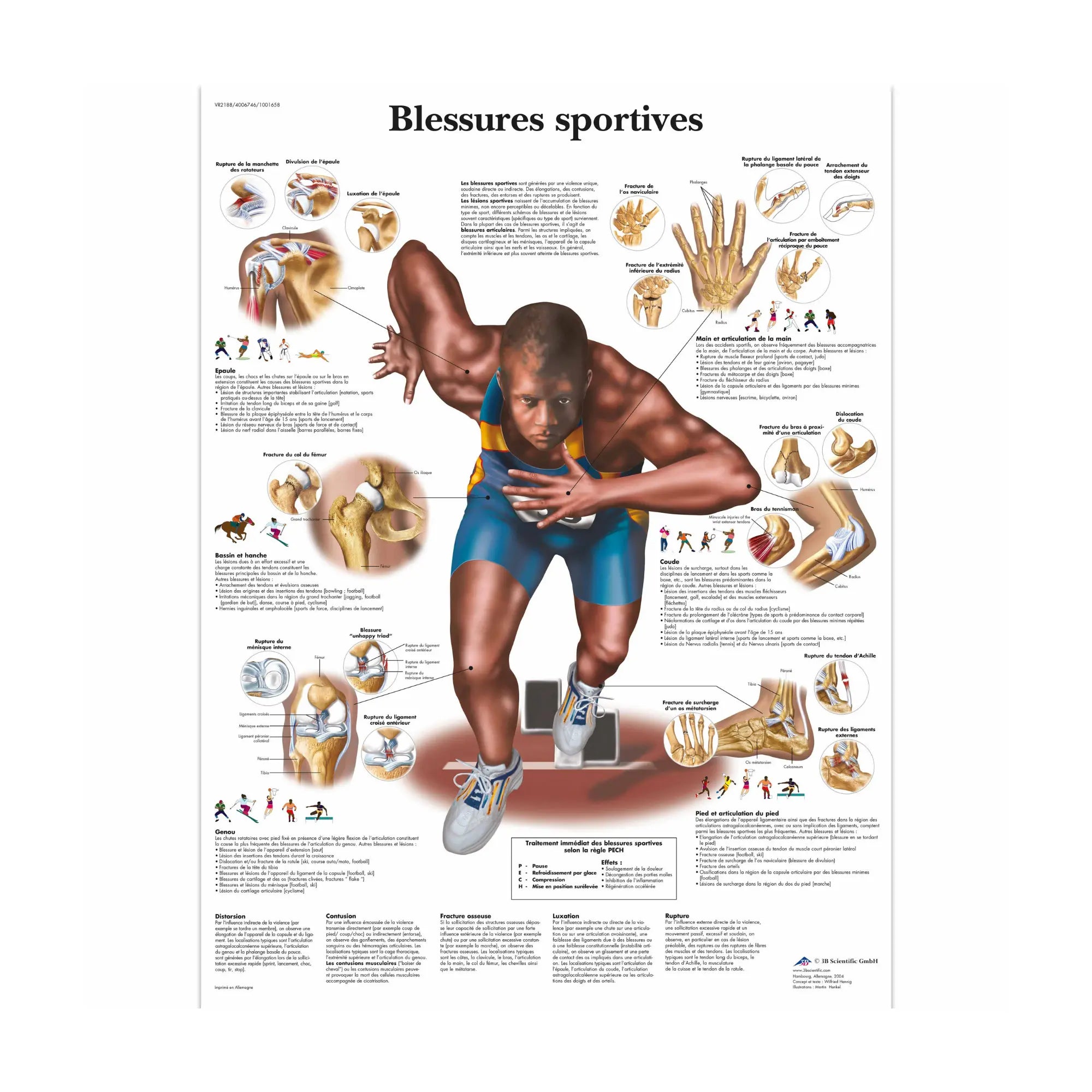 Planche anatomique - Blessures sportives - My Podologie