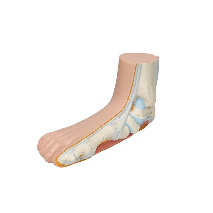 Squelette d'un pied plat (Pes Planus) - My Podologie