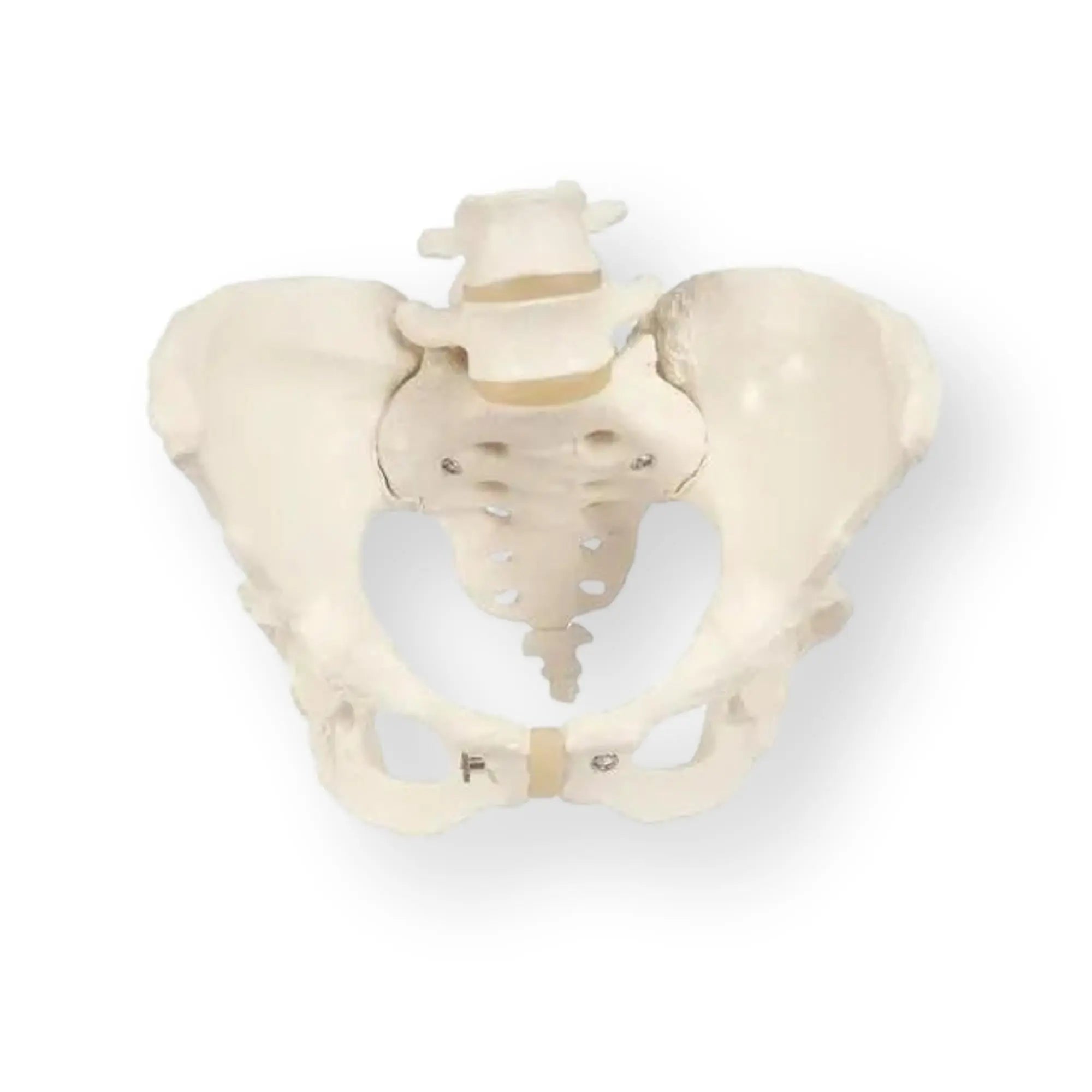 Pelvic skeleton, female - Anatomy and pathology