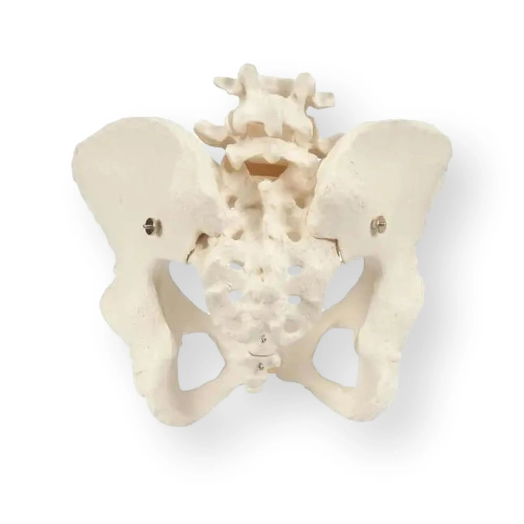 Pelvic skeleton, female - Anatomy and pathology